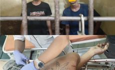 Permalink to Ngeri” Ditusukan Secara Membabi Buta Oleh 2 Tangan Kakak Beradik Etet Tewas Seketika